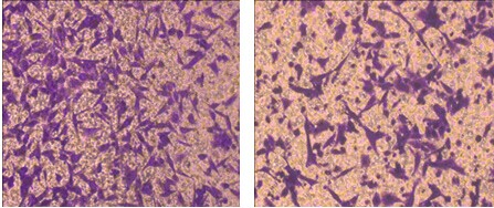 細(xì)胞遷移實(shí)驗(yàn)圖