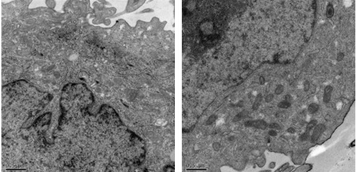 透射電鏡下細(xì)胞結(jié)構(gòu)